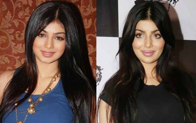 Ayesha Takia before after plastic surgery